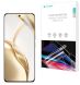 Защитная пленка на экран RockSpace SuperClear для Honor 200 (364125). Фото 1 из 10