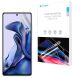 Защитная пленка на экран RockSpace Explosion-Proof SuperClear для Xiaomi 11T / 11T Pro (285812). Фото 1 из 10