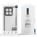 Защитный чехол DUX DUCIS Aimo Series для Xiaomi 15 Pro - Black (371102B). Фото 10 из 10