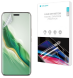 Защитная пленка на экран RockSpace Explosion-Proof SuperClear для Honor Magic 6 Pro (355827). Фото 1 из 10