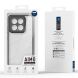 Защитный чехол DUX DUCIS Aimo Series для Xiaomi 15 - Black (371202B). Фото 10 из 10