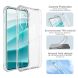 Захисний чохол IMAK Airbag MAX Case для OnePlus Nord 5 / Ace 5 Ultra - Transparent (387501T). Фото 4 з 9