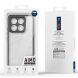 Защитный чехол DUX DUCIS Aimo Series для Xiaomi 14T - Black (365714B). Фото 13 из 13