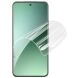 Защитная пленка IMAK Hydrogel Clear Film для Xiaomi 15 Pro (371124). Фото 2 из 11