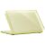 Защитная накладка UNIQ Vero Ultra Slim Clear Case для MacBook Neo (2026) UNIQ-MBNEO-VEROTCIT - Yellow: фото 1 из 3